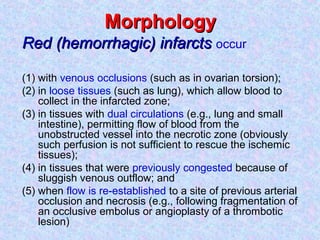 Infarctus Rouge 6 infarction | PPT
