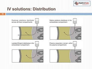 IV solutions: Distribution
30
 