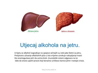 Utjecaj alkohola na jetru.
http://ucilica.skole.hr
U tijelu se alkohol razgrađuje na spojeve od kojih su neki jako štetni za jetru.
Pretjerano uživanje alkoholnih pića u isto vrijeme uzrokuje nakupljanje masti
što onemogućava jetri da uzima kisik. Imunološki sistem odgovara na to
tako da stvara upalni proces koji konačno uništava stanice jetre i nastaje ciroza.
 