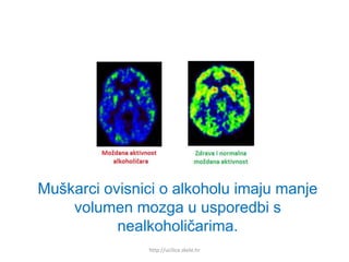 Muškarci ovisnici o alkoholu imaju manji
volumen mozga u usporedbi s
nealkoholičarima.
http://ucilica.skole.hr
 