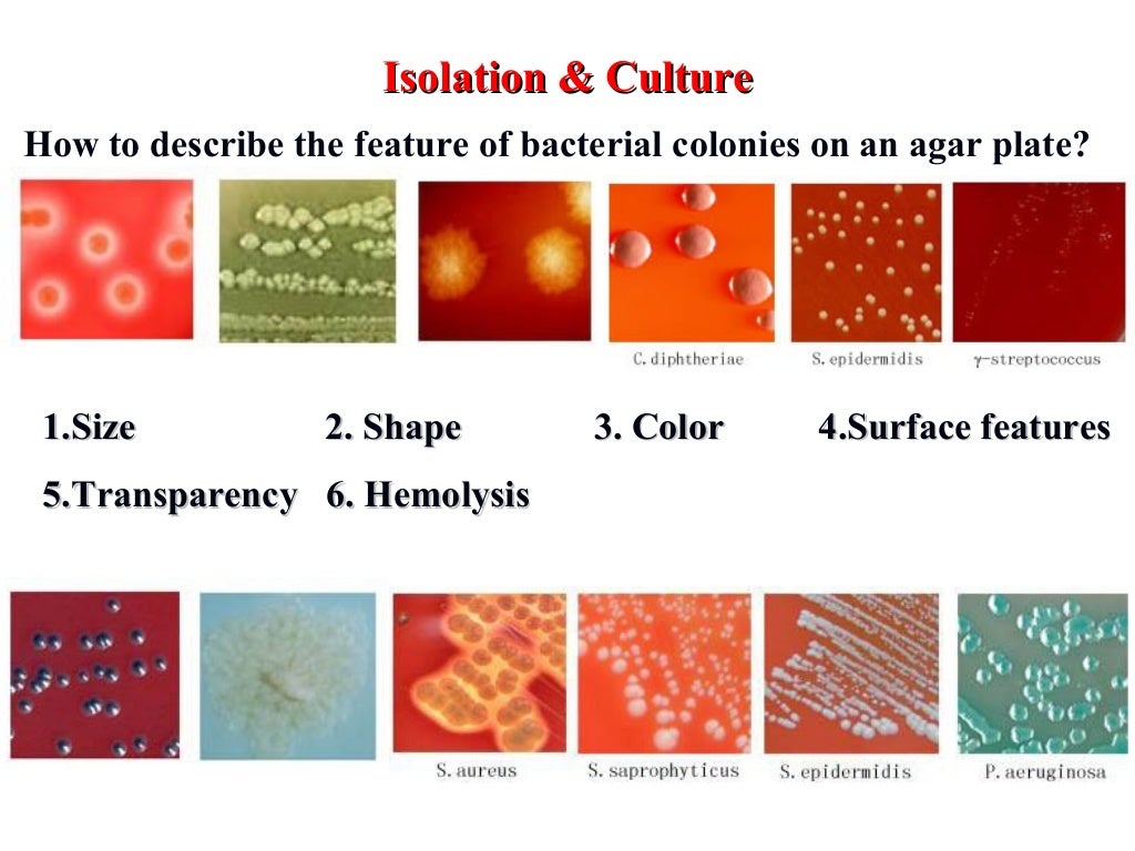 6 laboratory diagnosis of bacterial infection