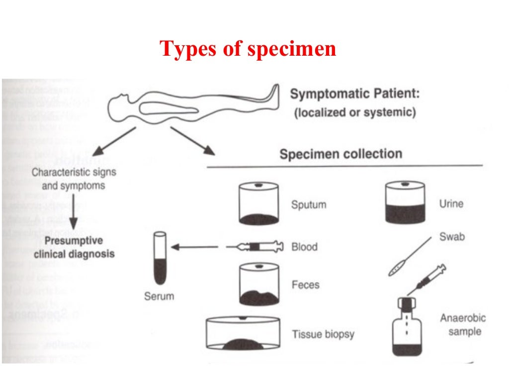 6 laboratory diagnosis of bacterial infection
