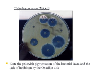 6-laboratorydiagnosisofbacterialinfection.pdf