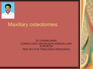 Maxillary osteotomies 
Dr V.RAMKUMAR 
CONSULTANT DENTAL&FACIOMAXILLARY 
SURGEON 
REG NO:4118-TAMILNADU-INDIA(ASIA) 
 