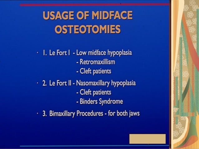 lefort osteotomies