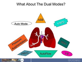 What About The Dual Modes?



                              ASB
                                             S
 Auto Mode                                VAP




        e
      ur tion                              MM
  e ss ta                                     V
Pr en
  gm
Au
        PRVC                   AutoFlow          VS
                tin America




                                                      V   I   T   A   L
 