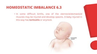 • In some difficult births, one of the sternocleidomastoid
muscles may be injured and develop spasms. A baby injured in
this way has torticollis or wryneck.
HOMEOSTATIC IMBALANCE 6.3
 