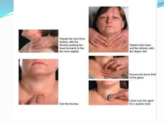 6-Neck swelling.pptx