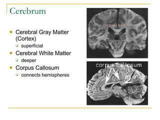 Cerebrum Cerebral Gray Matter (Cortex) superficial  Cerebral White Matter deeper  Corpus Callosum connects hemispheres 