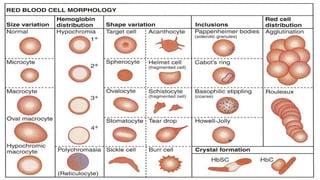 6 - Normal and Abnormal Red Blood Cells Morphology .pdf