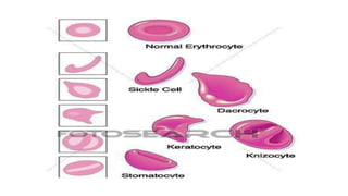 6 - Normal and Abnormal Red Blood Cells Morphology .pdf