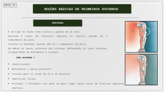 MÓDULO IV
NOÇÕES BÁSICAS DE PRIMEIROS SOCORROS
É um tipo de lesão onde ocorre a quebra de um osso.
Existem 2 tipos de fraturas: Exposta ou aberta: quando há o
rompimento da pele.
Interna ou fechada: quando não há o rompimento da pele.
Em ambos os casos, acontece dor intensa, deformação do local afetado,
incapacidade de movimento e inchaço.
 Imobilização;
 Movimentar o menos possível;
 Colocar gelo no local de 20 a 30 minutos;
 Improvisar talas;
 Proteger o ferimento com gase ou pano limpo (para casos de fraturas expostas ou
abertas).
COMO SOCORRER ?
FRATURAS
 