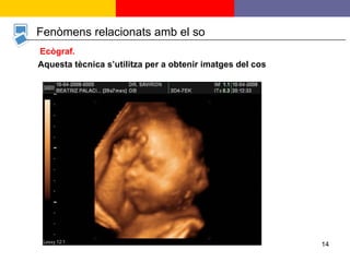 Aquesta tècnica s’utilitza per a obtenir imatges del cos Fenòmens relacionats amb el so Ecògraf. 