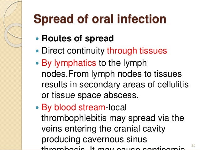 Abcessed tooth brain infection