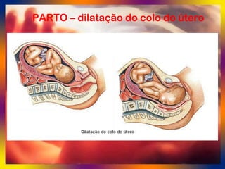 PARTO – dilatação do colo do útero 