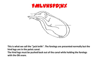 fMLVksfd;k% This is what we call the "jack knife". The forelegs are presented normally but the hind legs are in the pelvic canal.The hind legs must be pushed back out of the canal while holding the forelegs with the OB snare. 
