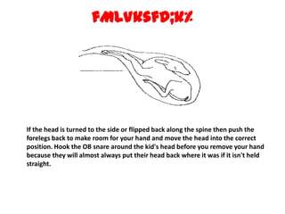 fMLVksfd;k% If the head is turned to the side or flipped back along the spine then push the forelegs back to make room for your hand and move the head into the correct position. Hook the OB snare around the kid's head before you remove your hand because they will almost always put their head back where it was if it isn't held straight. 