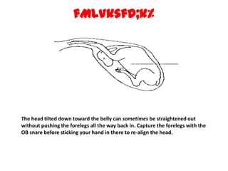 fMLVksfd;k% The head tilted down toward the belly can sometimes be straightened out without pushing the forelegs all the way back in. Capture the forelegs with the OB snare before sticking your hand in there to re-align the head. 