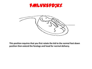 fMLVksfd;k% This position requires that you first rotate the kid to the normal feet down position then extend the forelegs and head for normal delivery. 