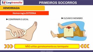 HemorragiaEXTERNA
NÃO utilize garroteamentoou torniquete
►COMPRIMIR O LOCAL ►ELEVAR O MEMBRO
HEMORRAGIA
 
