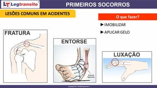 O que fazer?
►IMOBILIZAR
►APLICAR GELO
LESÕES COMUNS EM ACIDENTES
 