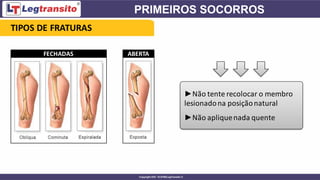 ►Não tente recolocar o membro
lesionadona posiçãonatural
►Não apliquenada quente
TIPOS DE FRATURAS
FECHADAS ABERTA
 