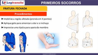 Procedimentos
►Imobilize a região afetada (prenda em 4 pontos)
►Apliquegelo para amenizar a dor e o inchaço
►Improvise uma tipóia para apoiodo membro
FRATURA FECHADA
 