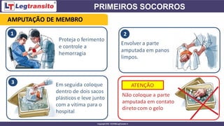 AMPUTAÇÃO DE MEMBRO
 