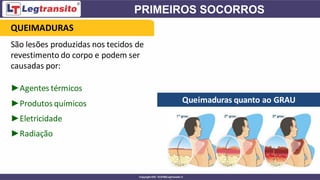►Agentes térmicos
►Produtos químicos
►Eletricidade
►Radiação
Queimaduras quanto ao GRAU
QUEIMADURAS
São lesões produzidas nos tecidos de
revestimento do corpo e podem ser
causadas por:
 
