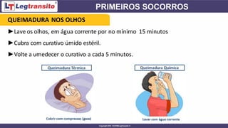 ►Lave os olhos, em água corrente por no mínimo 15 minutos
►Cubra com curativo úmido estéril.
►Volte a umedecer o curativo a cada 5 minutos.
QUEIMADURA NOS OLHOS
 