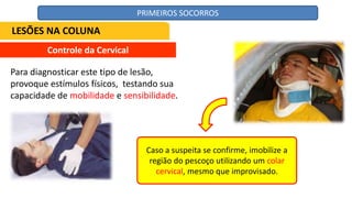 Controle da Cervical
Para diagnosticar este tipo de lesão,
provoque estímulos físicos, testando sua
capacidade de mobilidade e sensibilidade.
Caso a suspeita se confirme, imobilize a
região do pescoço utilizando um colar
cervical, mesmo que improvisado.
LESÕES NA COLUNA
PRIMEIROS SOCORROS
 