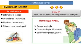 Procedimentos:
►Lateralizar a cabeça
►Controlar os sinais vitais
►Manter a temperatura
►Não dar nada para ingerir
Hemorragia NASAL
►Cabeça abaixada
►Compressão por 10 minutos
►Gelo ou compressa gelada.
Utilize EPI
Evite contato direto com sangramentos ou secreções.
HEMORRAGIA INTERNA
PRIMEIROS SOCORROS
 