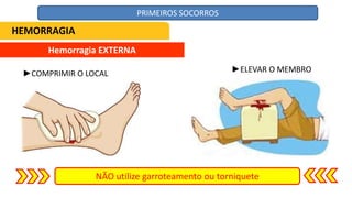Hemorragia EXTERNA
NÃO utilize garroteamento ou torniquete
►COMPRIMIR O LOCAL ►ELEVAR O MEMBRO
HEMORRAGIA
PRIMEIROS SOCORROS
 