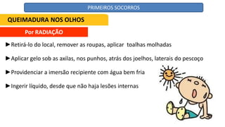 Por RADIAÇÃO
►Retirá-lo do local, remover as roupas, aplicar toalhas molhadas
►Aplicar gelo sob as axilas, nos punhos, atrás dos joelhos, laterais do pescoço
►Providenciar a imersão recipiente com água bem fria
►Ingerir líquido, desde que não haja lesões internas
QUEIMADURA NOS OLHOS
PRIMEIROS SOCORROS
 