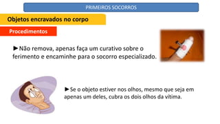 Procedimentos
►Não remova, apenas faça um curativo sobre o
ferimento e encaminhe para o socorro especializado.
►Se o objeto estiver nos olhos, mesmo que seja em
apenas um deles, cubra os dois olhos da vítima.
Objetos encravados no corpo
PRIMEIROS SOCORROS
 