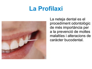 La Profilaxi
La neteja dental es el
procediment odontològic
de més importància per
a la prevenció de moltes
malaltíes i alteracions de
caràcter bucodental.
 