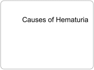Causes of Hematuria
 