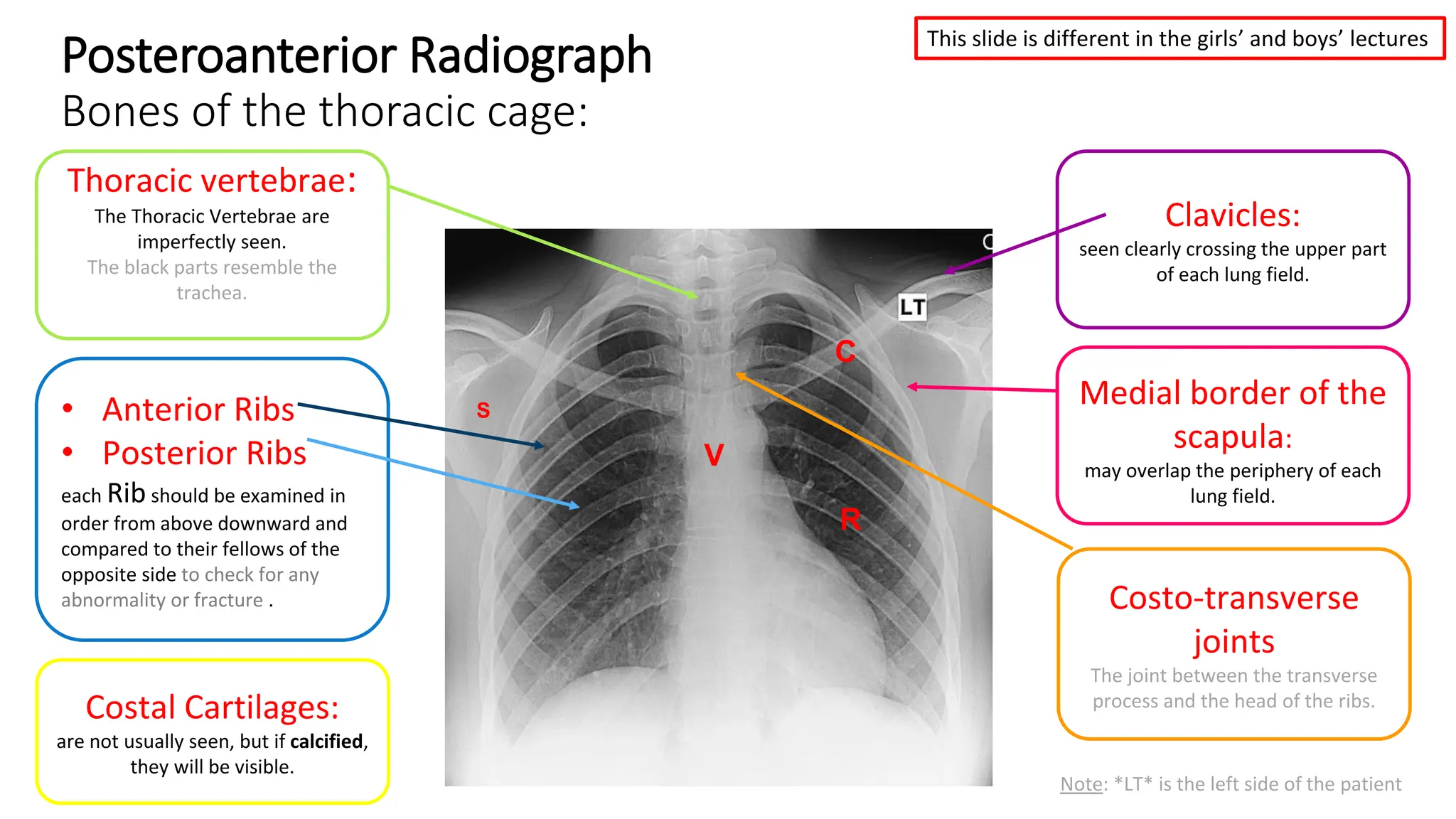 6-Radiological Anatomy Of The Chest..pdf