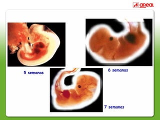 5 semanas
7 semanas
6 semanas
 