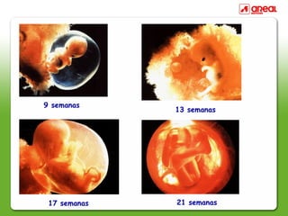 9 semanas
13 semanas
17 semanas 21 semanas
 