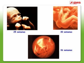 36 semanas
30 semanas25 semanas
 