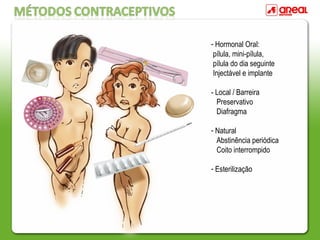 - Hormonal Oral:
pílula, mini-pílula,
pílula do dia seguinte
Injectável e implante
- Local / Barreira
Preservativo
Diafragma
- Natural
Abstinência periódica
Coito interrompido
- Esterilização
 