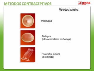 Métodos barreira
Preservativo
Diafragma
(não comercializado em Portugal)
Preservativo feminino
(abandonado)
 