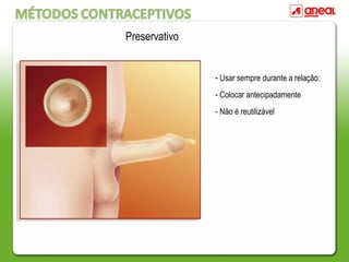 - Usar sempre durante a relação
- Colocar antecipadamente
- Não é reutilizável
Preservativo
 