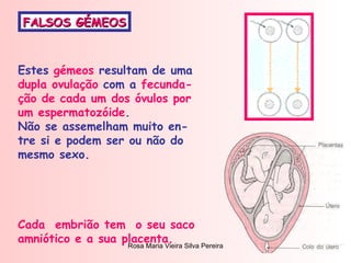 FALSOS GÉMEOS Estes  gémeos  resultam de uma  dupla ovulação  com a  fecunda- ção de cada um dos óvulos por um espermatozóide . Não se assemelham muito en- tre si e podem ser ou não do mesmo sexo.  Cada  embrião tem  o seu saco amniótico e a sua placenta. 