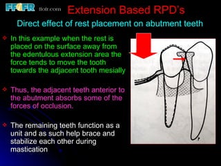 Internal Rest In Rpd 6.rpd design philosophies | PPT