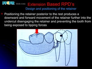 6.rpd design philosophies | PPT