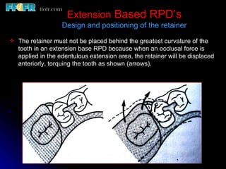 6.rpd design philosophies | PPT