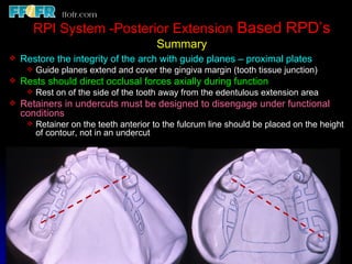 Rpi Bar Rpd 6.rpd design philosophies | PPT