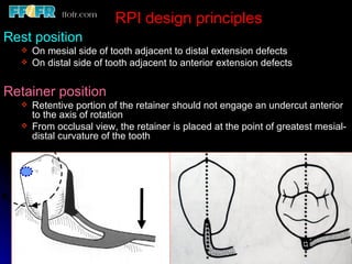 6.rpd design philosophies | PPT